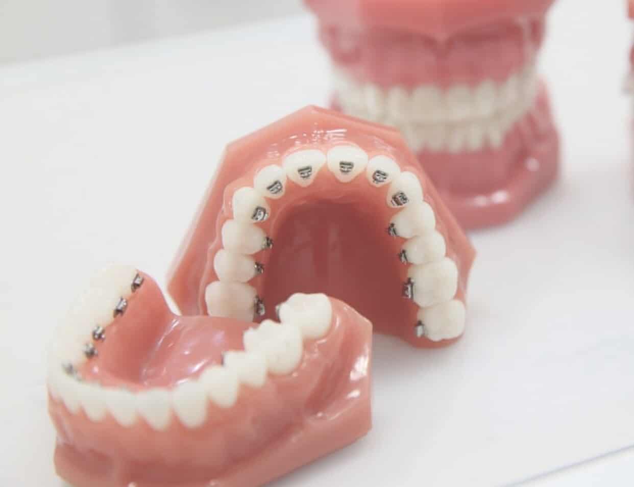 登士美牙醫診所 台中牙齒矯正推薦