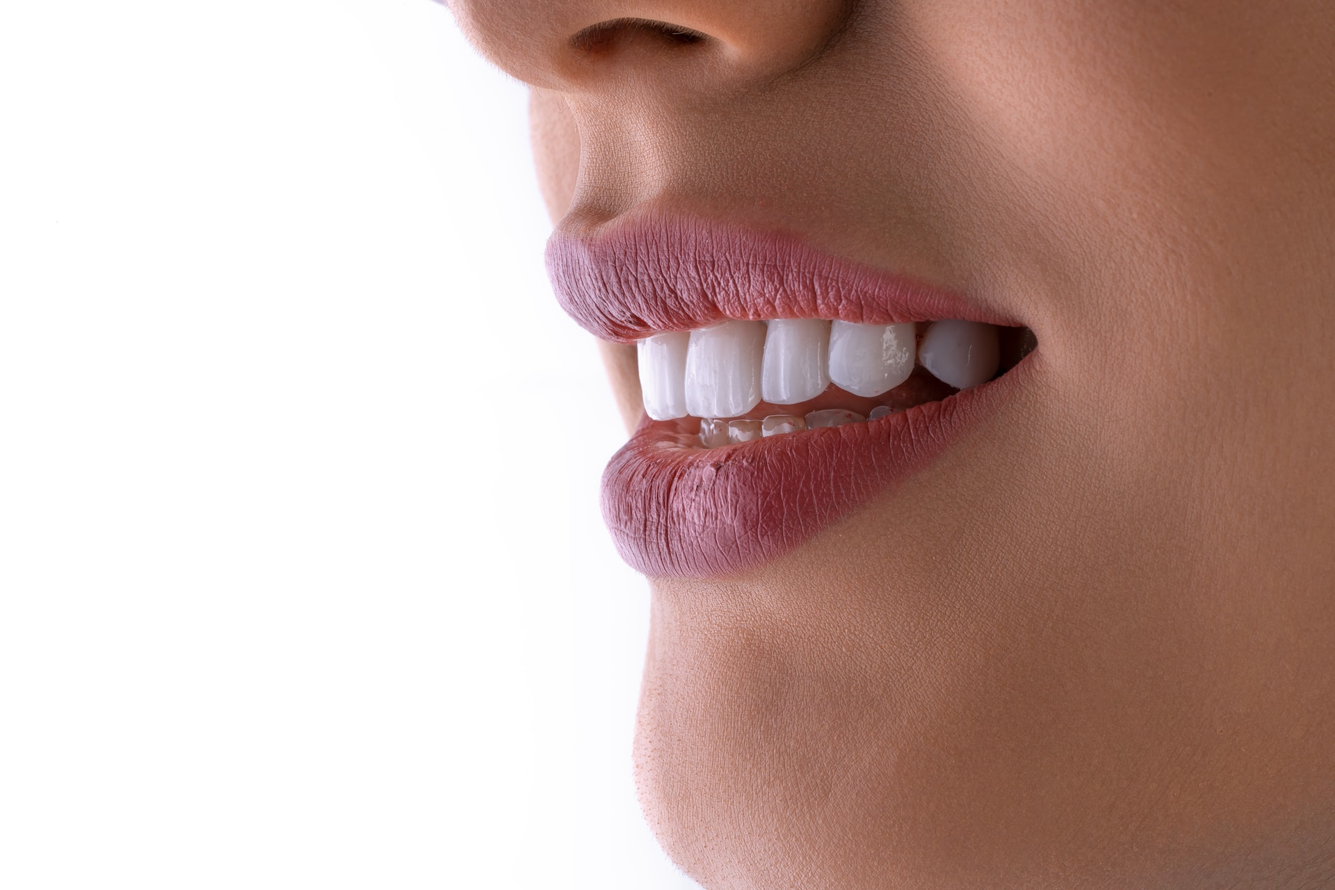 牙齒矯正需要牙弓擴張器嗎？｜適合族群、使用好處｜台中牙齒矯正
